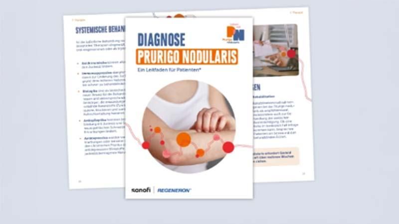 Broschüren zur Diagnose, zur psychischen Gesundheit bei Prurigo nodularis und einen Ratgeber fürs Arztgespräch